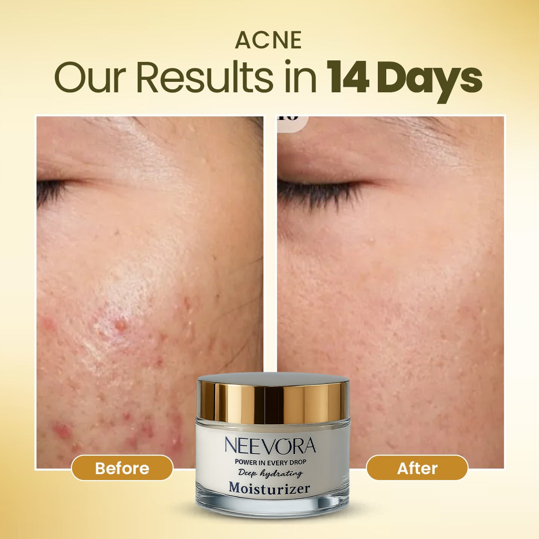 Neevora Deep Hydrating Moisturizer