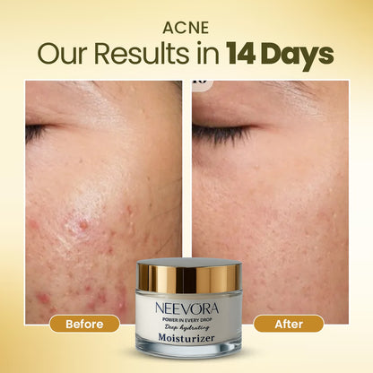 Neevora Deep Hydrating Moisturizer